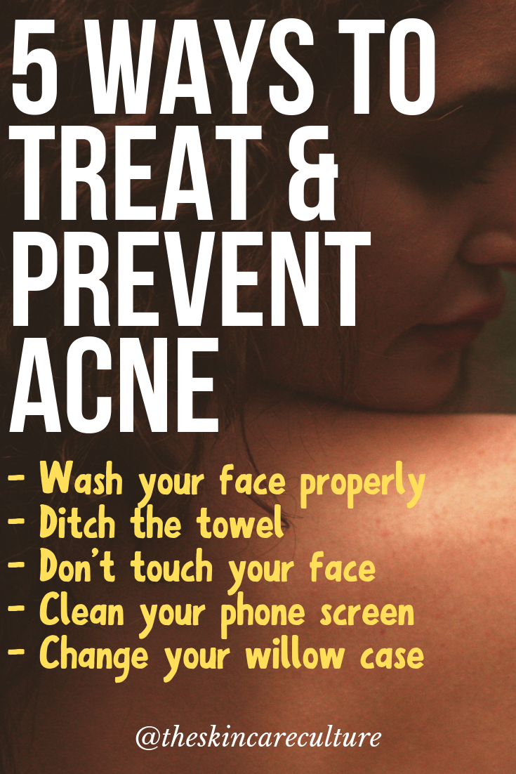How To Treat & Prevent Acne With 5 Simple Hygiene Tips The Skin Care
