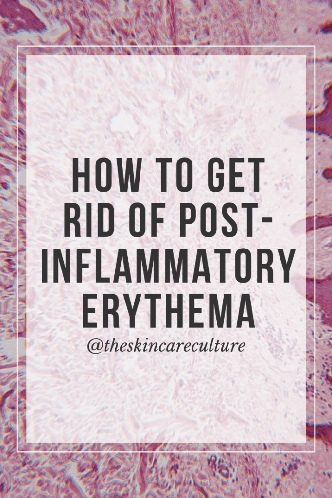 What Is PostInflammatory Erythema (& How To Get Rid Of It)?