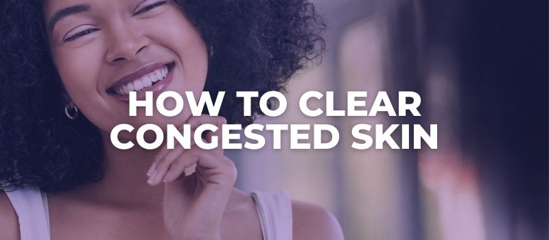 how to clear congested skin