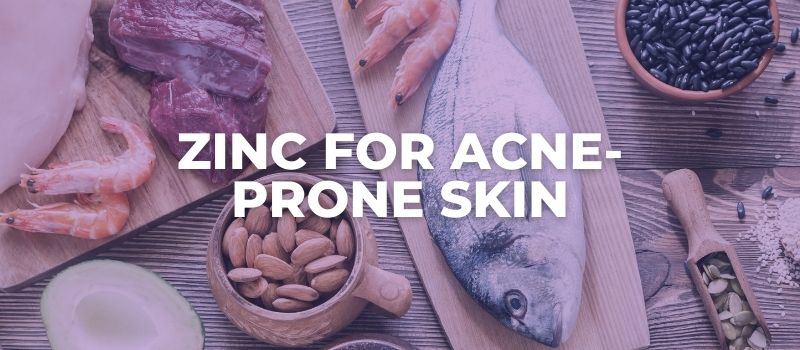 zinc benefits for acne prone skin