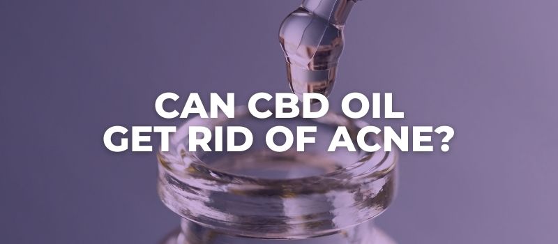 can cbd oil get rid of acne