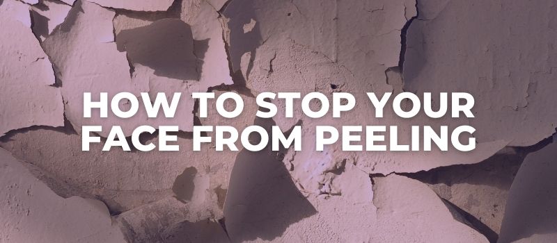 how to stop your face from peeling