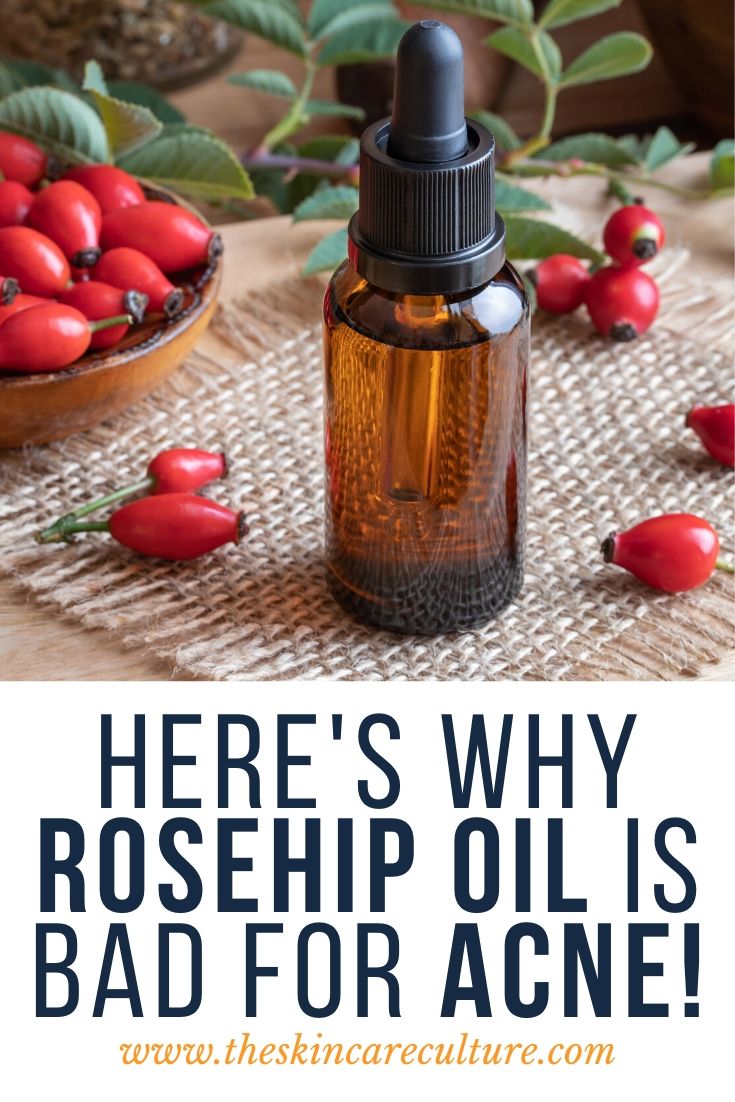 Here's Why Rosehip Oil Is Bad For Acne