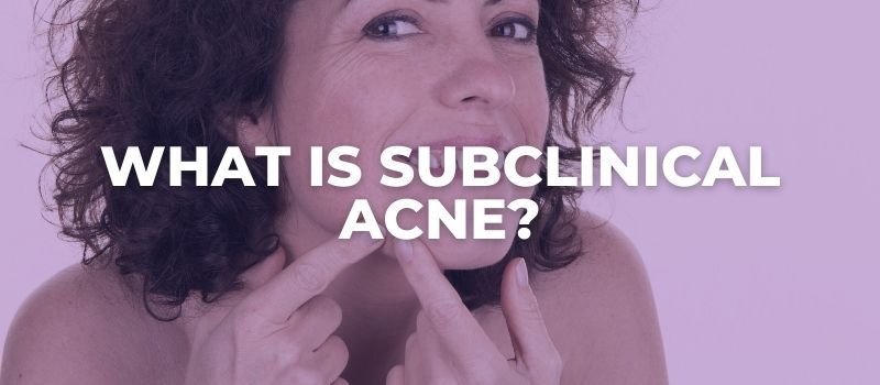 What Is Subclinical Acne?