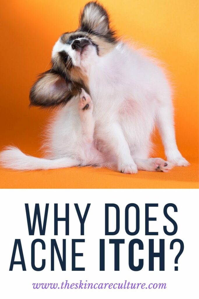 Why Does Acne Itch (& What Can You Do About It)?