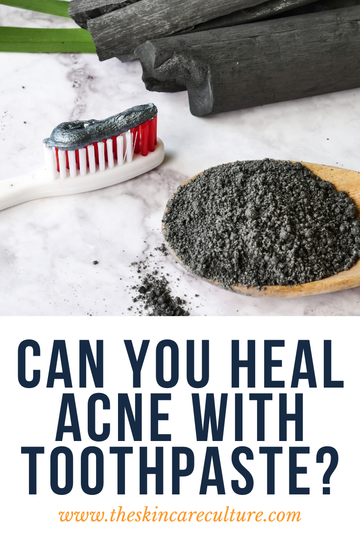 Can You Use Toothpaste on Acne?