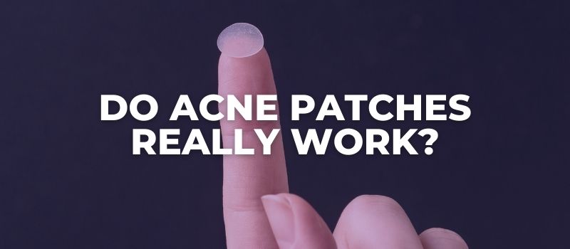 Do Acne Patches Really Work?