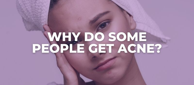 why do some people get acne when others dont