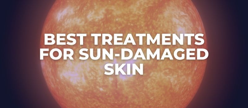 Best Treatments For Sun-Damaged Skin