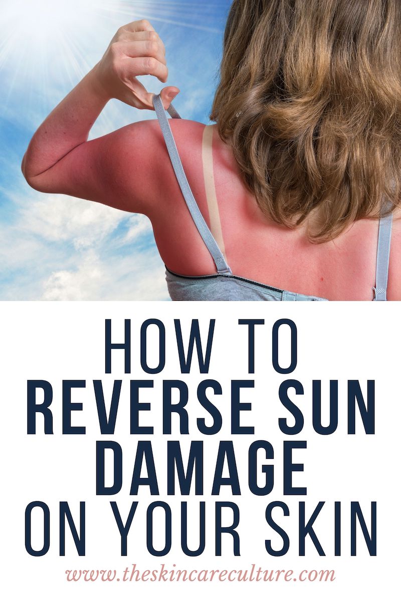 how-to-reverse-sun-damage-on-your-skin