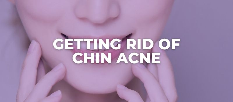 how to get rid of chin acne