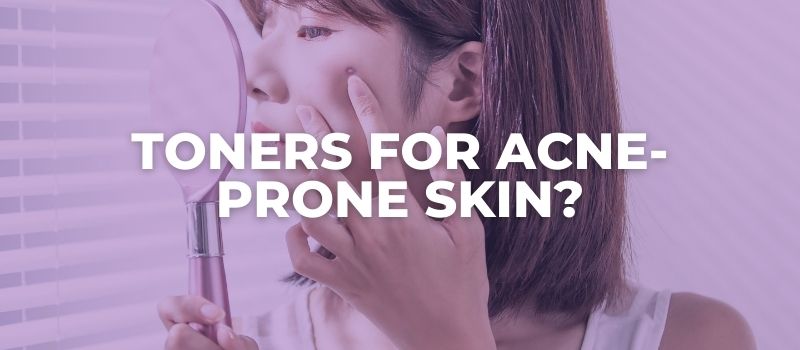 toners for acne prone skin