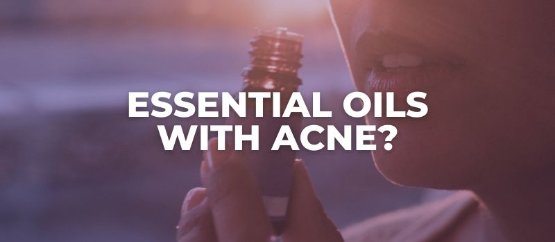 essential oils on acne