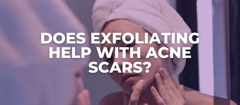 Does Exfoliating Help With Acne Scars?