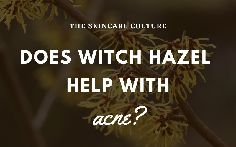 Does Witch Hazel Help With Acne?