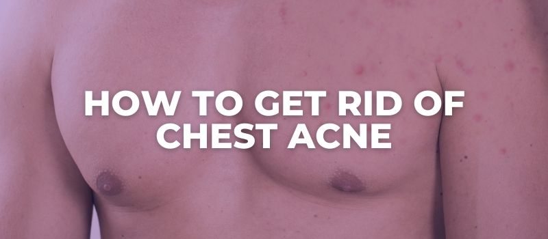 how to get rid of chest acne