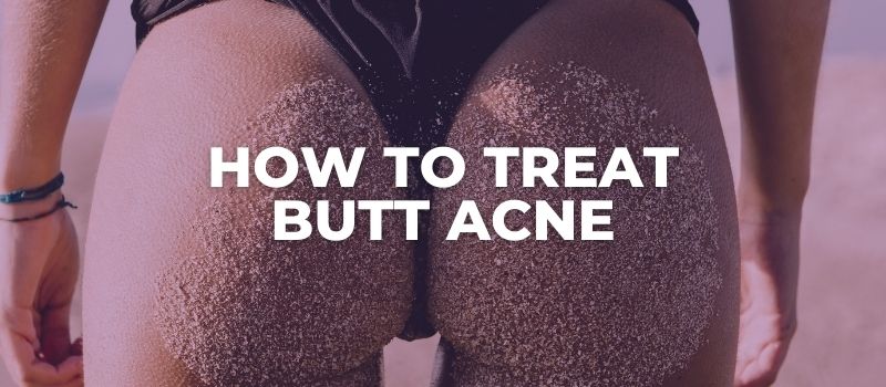 how to treat butt acne