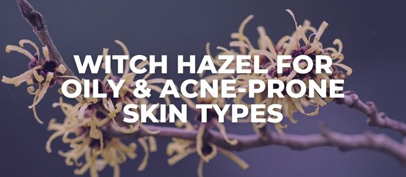 witch hazel for oily and acne prone skin