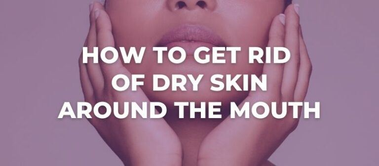6 Tips On How To Get Rid Of Dry Skin Around The Mouth How To Get Rid Of Dry Skin Around The Mouth 768x336
