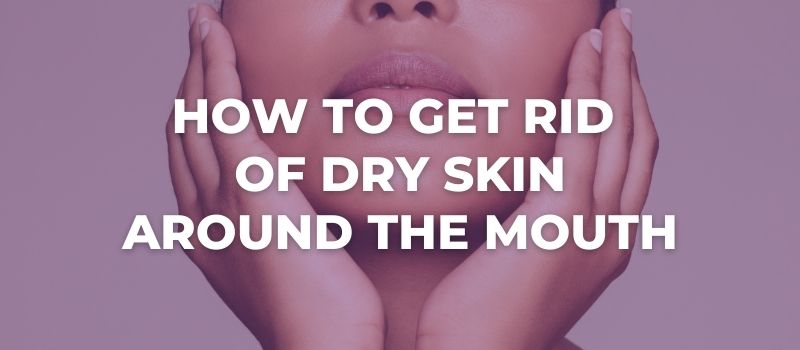 6 Tips On How To Get Rid Of Dry Skin Around The Mouth