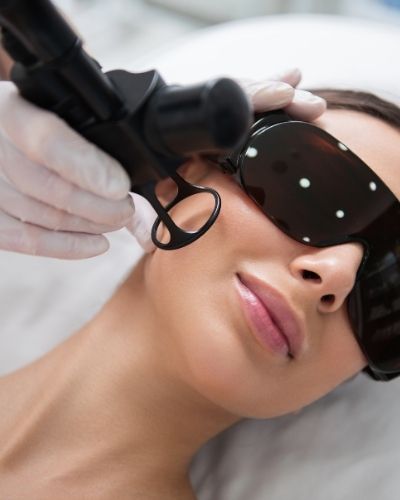 Laser For Acne Scars