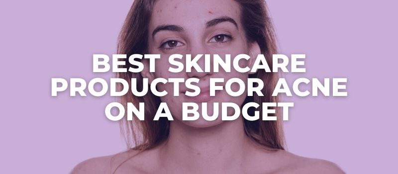 Best Skincare Products For Acne On A Budget