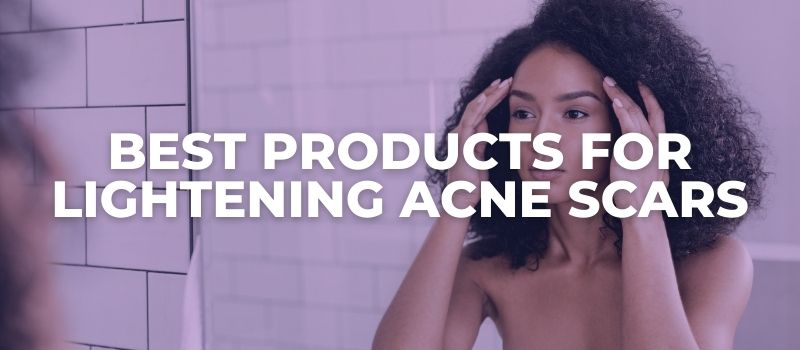 Best Products for Lightening Acne Scars - The Skincare Culture
