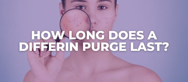 how long does a differin purge last