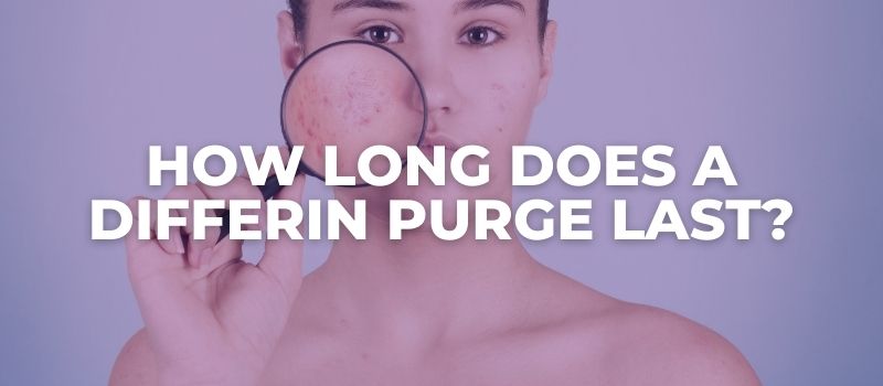 how-long-does-a-differin-purge-last