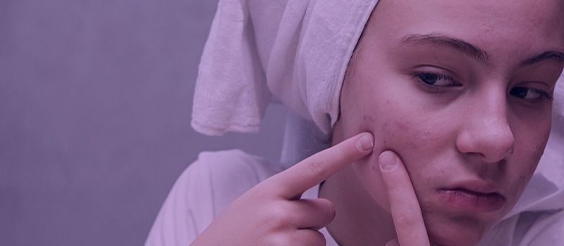 Does Accutane Get Rid of Closed Comedones - The Skincare Culture