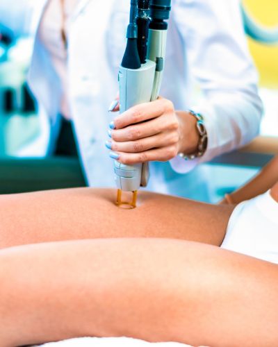 How Long After Accutane Can You Do Laser Hair Removal - The Skincare Culture