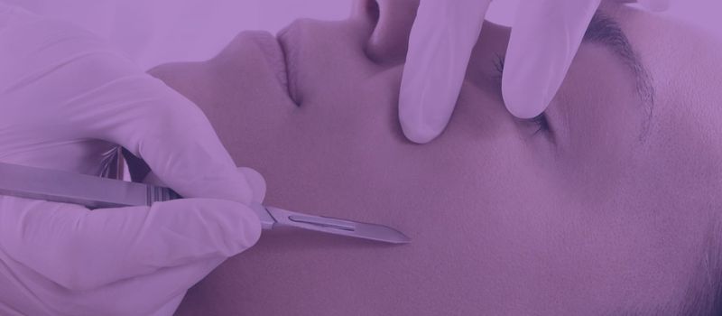 can you dermaplane while on accutane