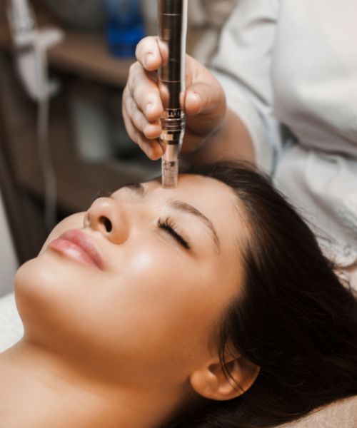 A woman sitting at the dermatologist getting a Microneedling treatment for Post-Inflammatory Erythema.