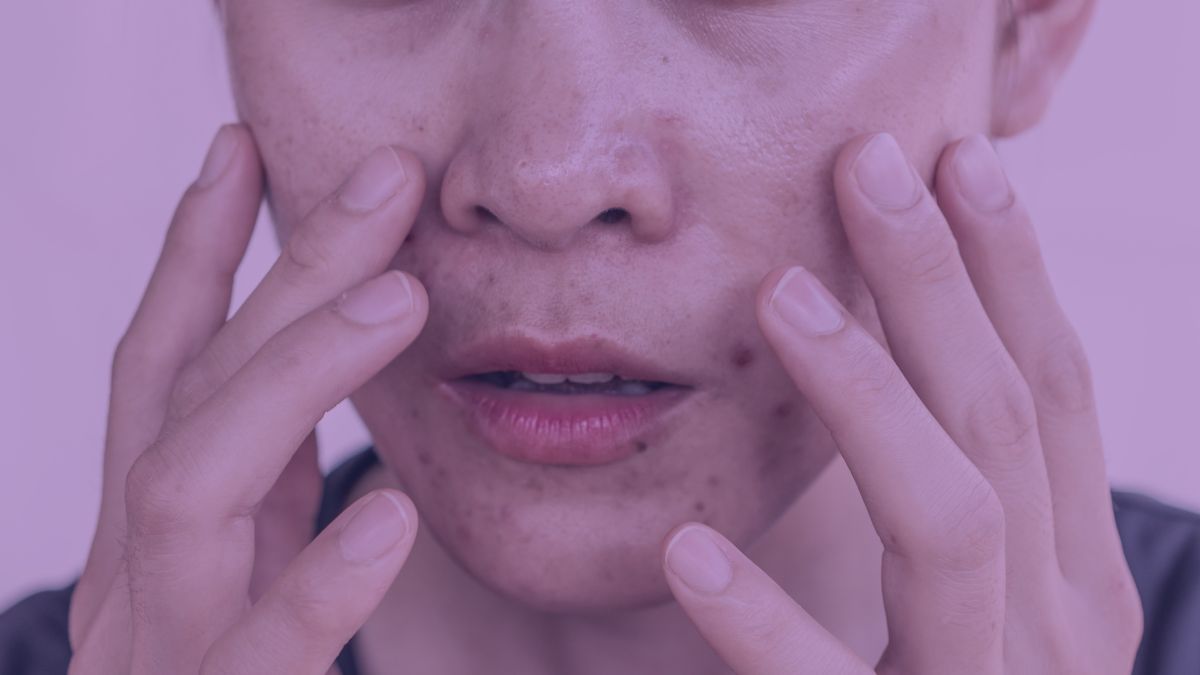 A woman with oily skin holding her hands up to her face wondering in the mirror how to control her oily skin.