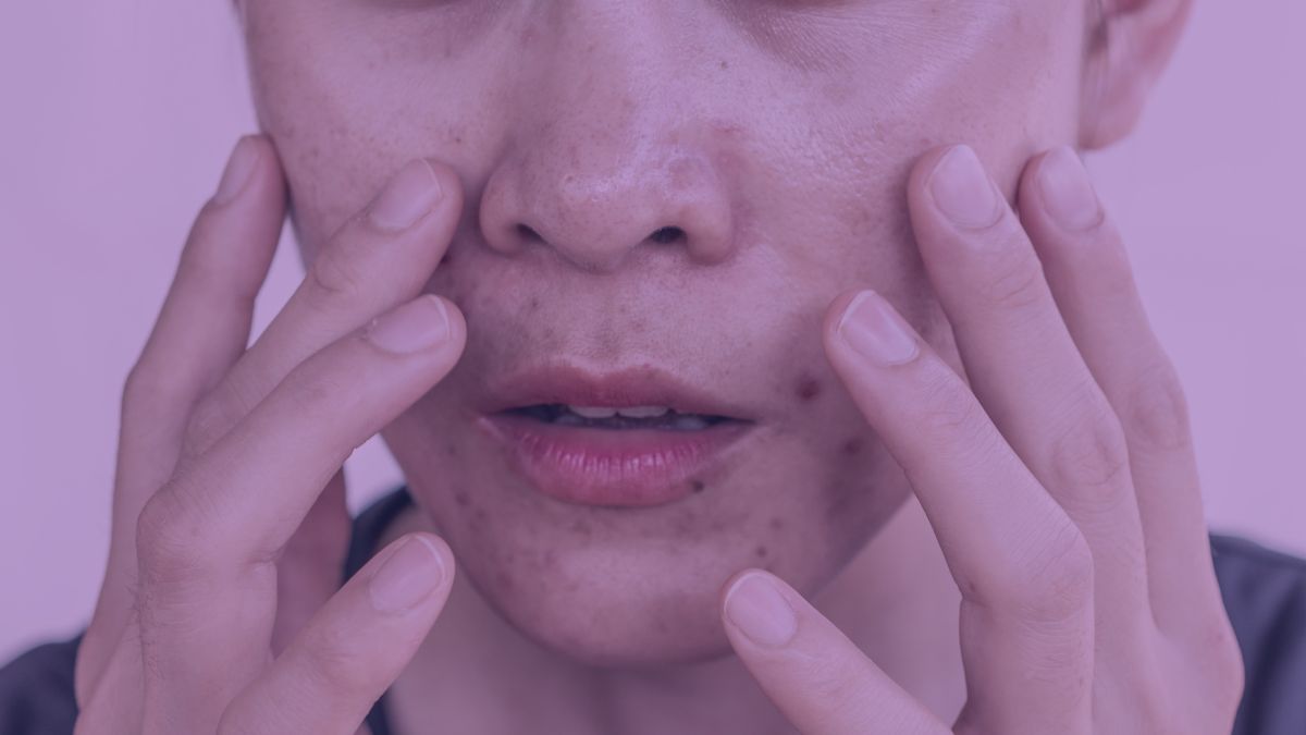 A woman with oily skin holding her hands up to her face wondering in the mirror how to control her oily skin. 