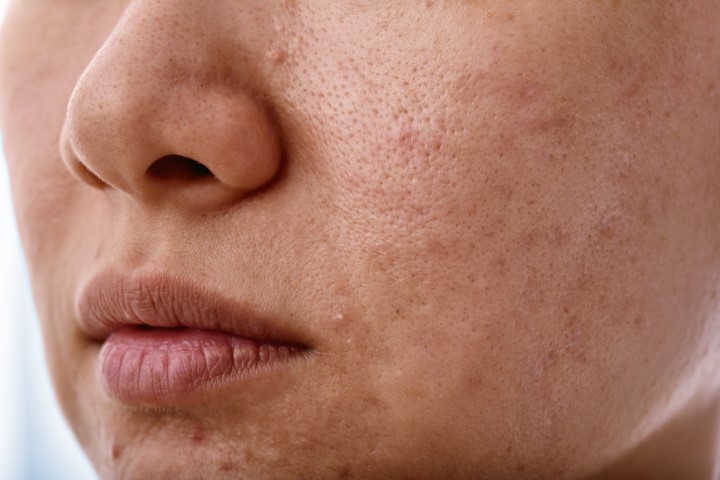 what does congested skin look like?